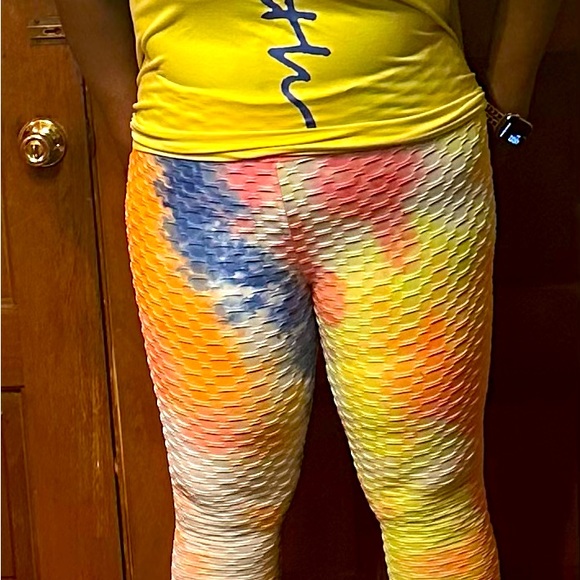 Before and After Pics - Picture 2 of 2